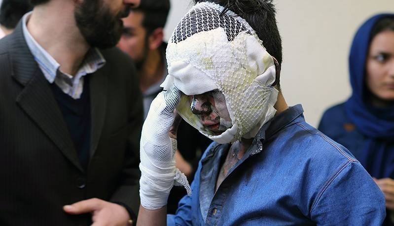 افزایش آمار سوختگی در اصفهان