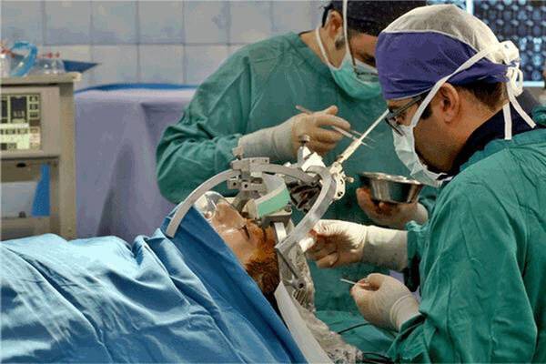 انجام موفقیت آمیز جراحی مغز با هوشیاری بیمار در کاشان