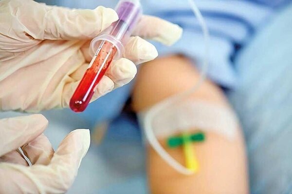 ۱۰۸ بیمار هموفیلی در کاشان خدمات مستمر دریافت می‌کنند